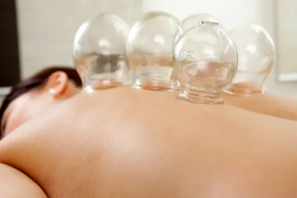 Body & Mind Cupping Treatment
